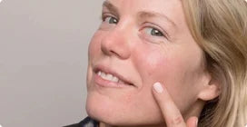 Acne face mapping: What your skin is trying to tell you